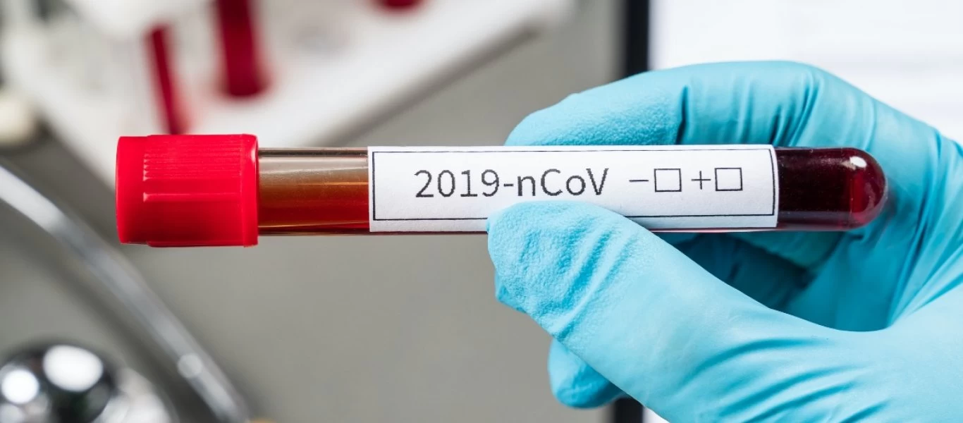 Κορωνοϊός: Υποχρεωτική από το Σάββατο η χρήση μάσκας στη Γουινέα - Θα επιβάλλεται πρόστιμο στους ανυπάκουους